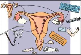 Contraception : résultats belges d’une étude internationale CHOICE