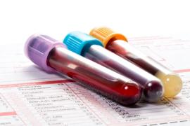 8 centres belges de génétique proposent un test ADN pour détecter la trisomie