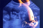 Avis n°53 : Com. Cons. Bioéthique effet sur foetus