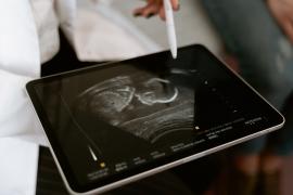 Abortustermijn van 12 naar 14 weken in Frankrijk: schadelijke gevolgen voor vrouwen en artsen