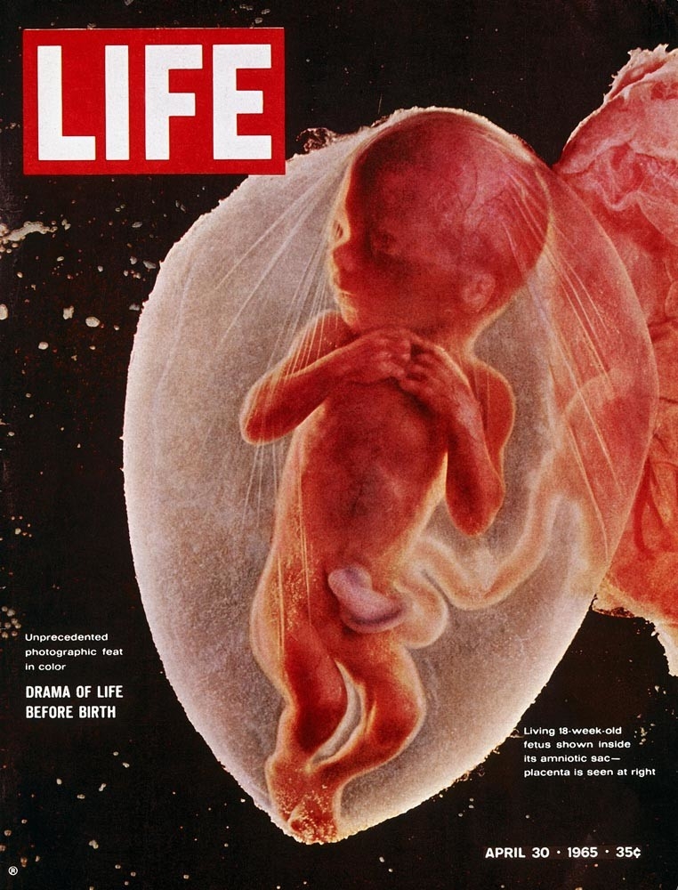 Foetus De 4 Mois Photo Une Majorite Politique S Apprete A En Autoriser L Avortement Institut Europeen De Bioethique